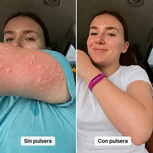 Solvix - Pulsera repelente anti mosquitos con aceites esenciales